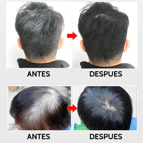 Shampoo Cubre Canas Negro o Castaño 400 ML Original 🧑🦳❌✨🧑