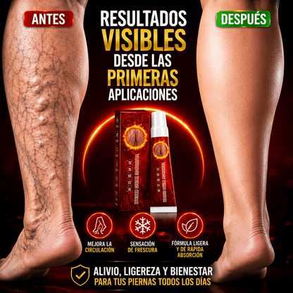Crema pomada alivio total para varices