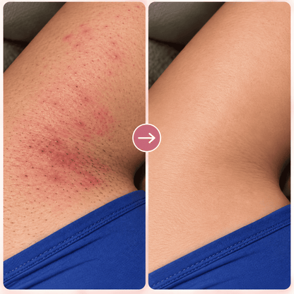 Depiladora Laser IPL Pro - Menos irritación. Menos vello. Más suavidad.